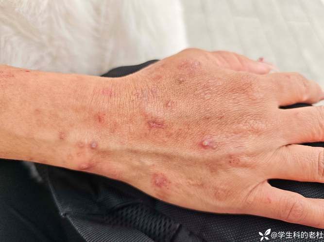 掇刀区现有阳性感染者20例_掇刀区新增