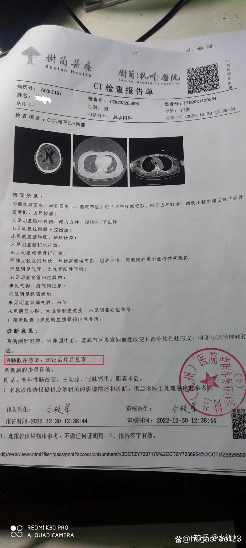  襄城县累计报告无症状感染者29例:襄城县确诊新型肺炎