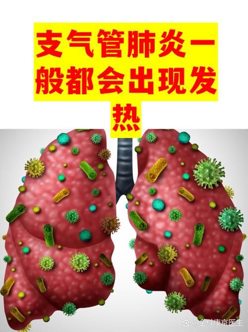 【浙江衢州开化县近期新增感染趋势蔓延_浙江衢州开化有新型肺炎吗?】