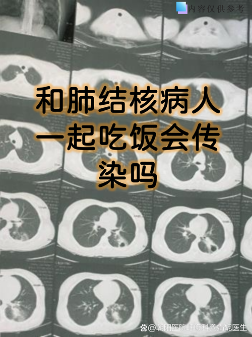  河南濮阳濮阳经济技术开发区新增11例阳性感染者及27例无症状:濮阳新增2例新型肺炎