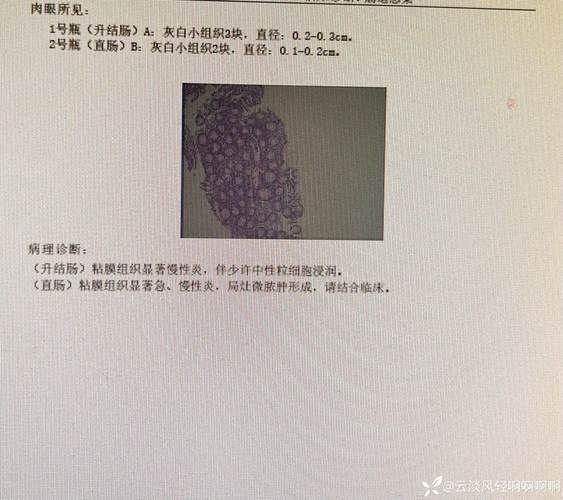 贵州黔西南布依族苗族自治州兴义9月11日新增5例境外输入病例_贵州兴义冠状病毒一例