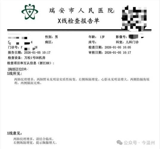  山东省临沂市兰陵县1月17日新增感染趋势蔓延:临沂兰陵确诊病例