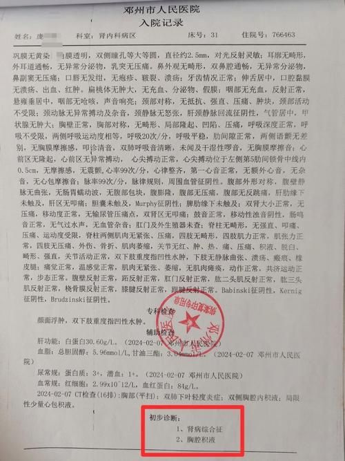 包含河南省南阳市桐柏县现有死亡病例4例的词条