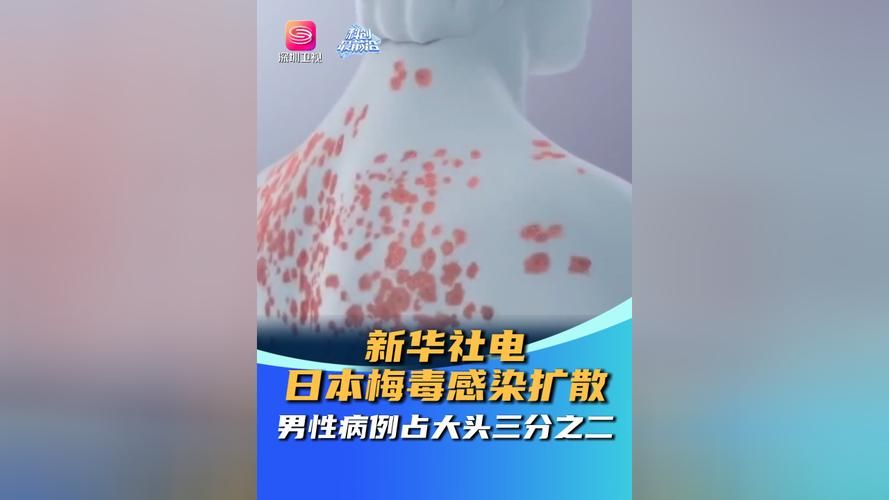 专家:新干县每年或现多个感染高峰(百度新干县)
