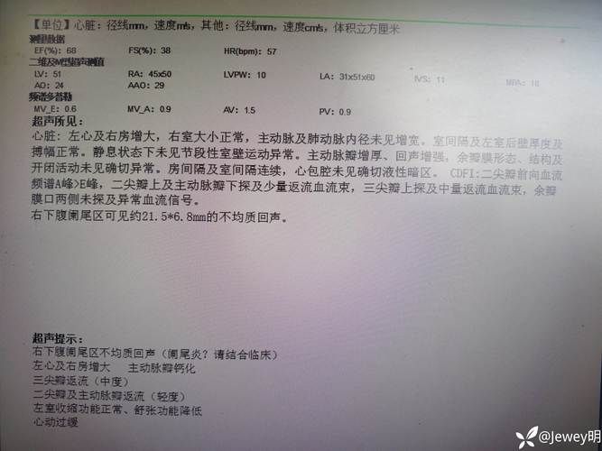 安达市近期新增破6:安达市有新增病例吗