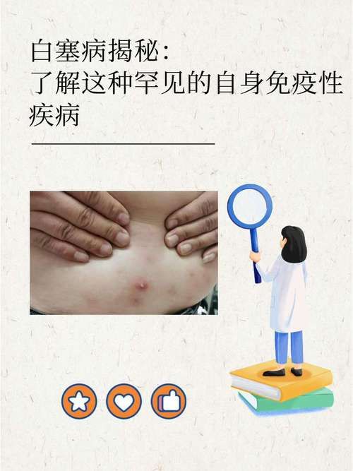 青海西宁城西区封城区无症状感染者详情(青海西宁城西区疫情)
