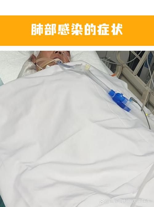 【全球新增阳性感染者4例均在龙州县,全球新增肺炎】