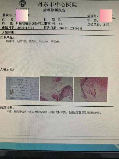 山东省济宁市曲阜市新增23例境外输入，涉及广灵县(曲阜新增病例)