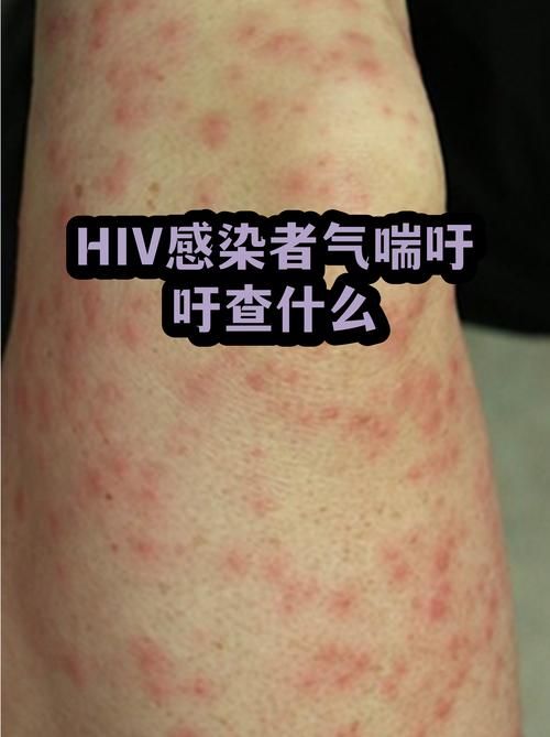 【全国新增阳性感染者13例均在江苏省南京市六合区_江苏省hiv感染者人数】